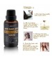 Cidbest Anti Hair Loss Promotes Hair Growth Solution for Hair Thinning and Loss Hair Regrowth